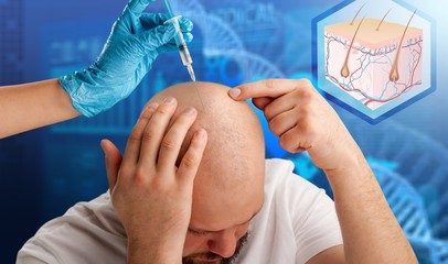 hair transplant clinic