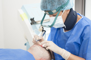 hair transplant clinic in uk