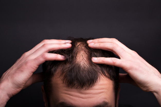 hair loss treatment