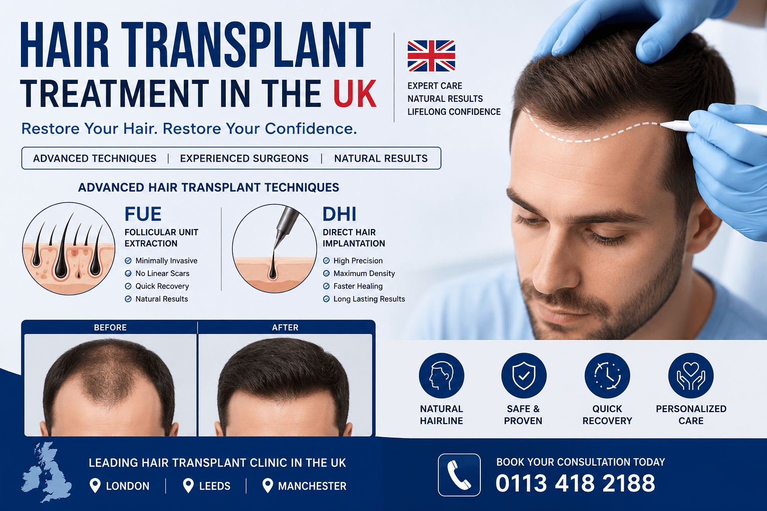 Hair Transplant UK